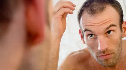 9 mituri despre căderea părului la bărbaţi
