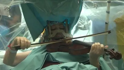O violonistă a dat un adevărat recital în timp ce era operată pe creier VIDEO