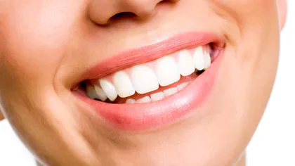 Cum să ai dinţii strălucitor de albi