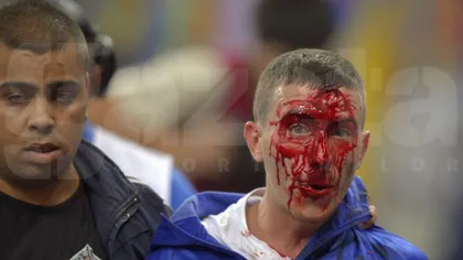 Incidente grave la ROMÂNIA-UNGARIA. Scaune rupte, gaze lacrimogene, suporteri bătuţi - UPDATE