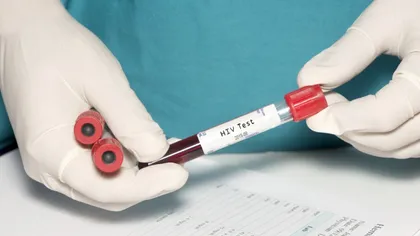 O nouă terapie genică ar putea oferi o protecţie pe termen lung împotriva HIV