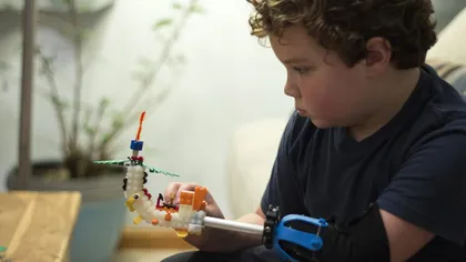 Un copil şi-a făcut singur o PROTEZĂ BIONICĂ funcţională cu ajutorul unor elemente de Lego