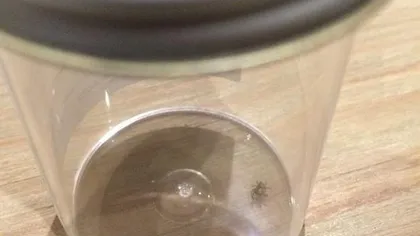 O cântăreaţă celebră a trăit o săptămână cu un păianjen în ureche FOTO