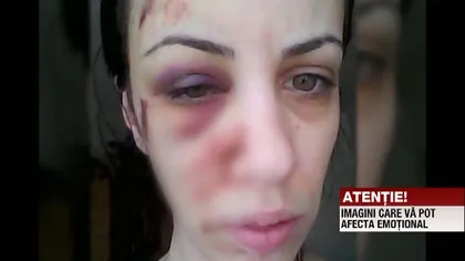 O tânără este bătută frecvent de fostul concubin. Femeia a cerut ajutor pe Facebook VIDEO