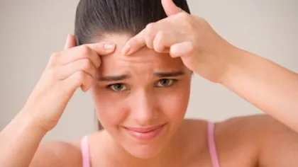 Cauze nebănuite ale apariţiei acneei