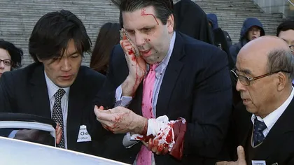 Mark Lippert, ambasadorul american la Seul, a fost rănit într-un atac