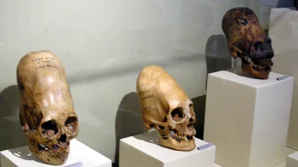 Descoperiri care pot schimba istoria omenirii. Craniile Paracas şi craniul lui NAPOLEON BONAPARTE