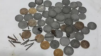 Un bărbat a înghiţit sute de monede, cuie şi alte metale. Medicii au fost şocaţi de ceea ce au găsit VIDEO