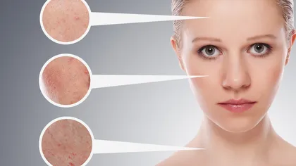 Afecţiuni ale pielii care îţi pot semnala alte probleme de sănătate
