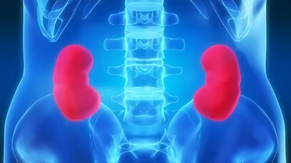 Cum scapi de pietrele la rinichi în doar 10 zile