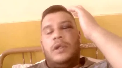 Un tânăr, în stare gravă la spital după ce a fost bătut de fiul unui fost procuror VIDEO