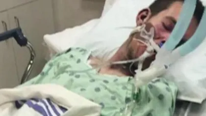 Bărbat de 21 de ani, desfigurat, după ce o ţigară electronică i-a explodat în faţă