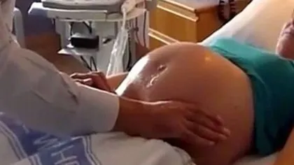 A leşinat când şi-a văzut bebeluşul! Ce a născut o femeie care a fost expusă radiaţiilor pe timpul sarcinii