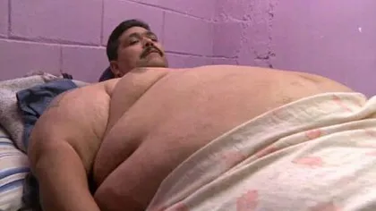 Cel mai gras om din lume a fost operat cu succes în Mexic: Bărbatul are 435 de kilograme VIDEO