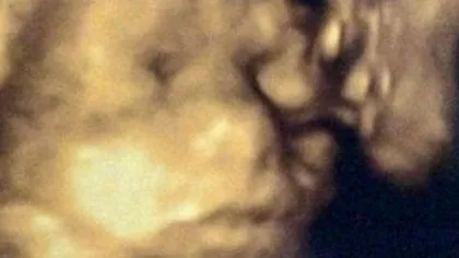 O femeie însărcinată a avut ŞOCUL vieţii ei la ecografie! Cine îi săruta bebeluşul din pântece