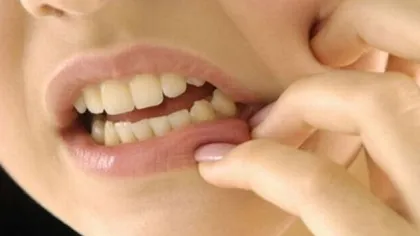 Remedii naturiste pentru durerile de dinţi