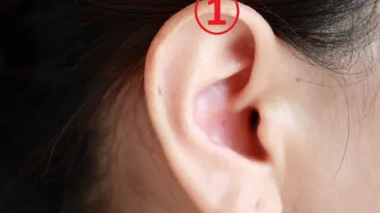 Vezi ce se întâmplă dacă îţi prinzi lobul urechii cu un cârlig de rufe