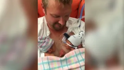 IMAGINI IMPRESIONANTE: Gemeni nou-născuţi se ţin de mânuţe VIDEO
