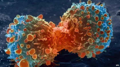 STUDIU: Cancerul poate fi provocat de cromul prezent în suplimentele alimentare