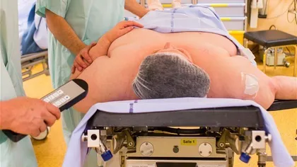 Viaţa unui bărbat de 300 de kilograme a fost salvată de medicii din Iaşi