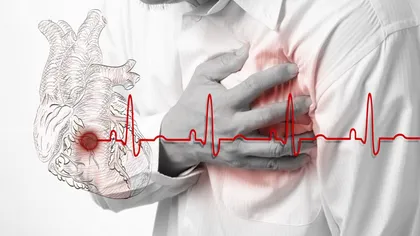 Un simptom surprinzător te anunţă dacă faci infarct