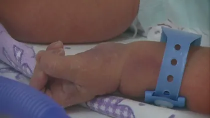 CAZUL bebeluşilor infectaţi: Trei, în stare gravă la Terapie Intensivă. Ministrul Sănătăţii, vizită la Marie Curie VIDEO