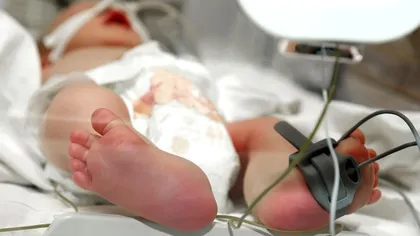 Un al doilea copil diagnosticat cu sindrom hemolitic-uremic a murit în spital