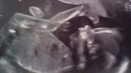 Şocul unei gravide: A văzut o fantomă pe ecografia cu bebeluşul ei nenăscut