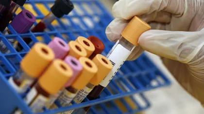 Testul de sânge care depistează cancerul încă din primele stadii. Cât costă o astfel de analiză