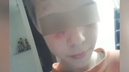 Caz şocant în Bacău. Un copil de nouă ani a fost maltratat de propria mamă