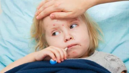 CMR, îngrijorat de situaţia care a dus la apariţia epidemiei de rujeolă: Vaccinarea este cel mai important act