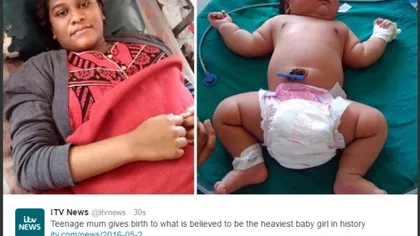 S-a născut fetiţa cu greutatea unui copil de şase luni. Este din India şi cântărea la naştere şapte kilograme
