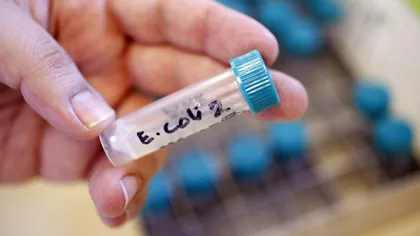 ANSVSA va demara luni un Plan naţional de control pentru depistarea E-coli în carne şi lapte