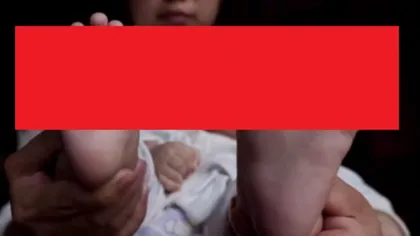 Cazul incredibil care a şocat medicii. S-a născut cu 31 de degete la mâini şi la picioare VIDEO