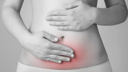 Ce este sindromul ovarelor polichistice?