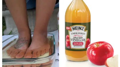 VIDEO! Femeia asta şi-a înmuiat picioarele în oţet de mere în fiecare zi, timp de o lună. Află de ce şi ce i s-a întamplat apoi