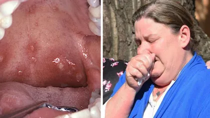 I-au apărut afte în gât, însă medicii au ignorat-o. Trebuie să afli de ce a murit o fetiţă de 10 ani