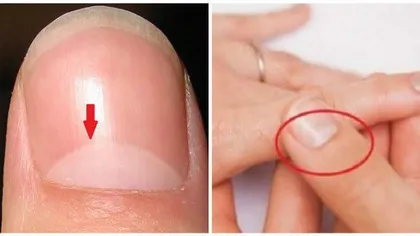 Ştii ce înseamnă semiluna de pe unghiile tale? Răspunsul este mai important decât crezi