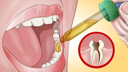 Asta e cea mai uşoară metodă prin care scapi de durerile de dinţi! Stomatologii sunt uimiţi