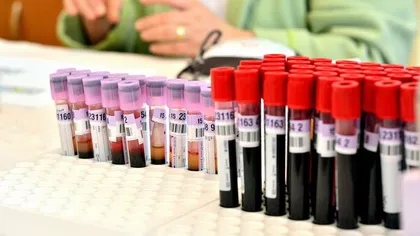 Peste 550 de unităţi de sânge au fost colectate într-o campanie derulată de studenţii medicinişti
