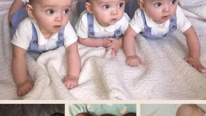 A născut tripleţi dar nimeni nu se aştepta ca unul dintre ei să arate AŞA. Până şi medicii au fost surprinşi