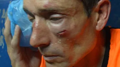 Scene de violenţă rară pe terenul de fotbal. Un arbitru a fost bătut cu bestialitate de jucători şi suporteri VIDEO