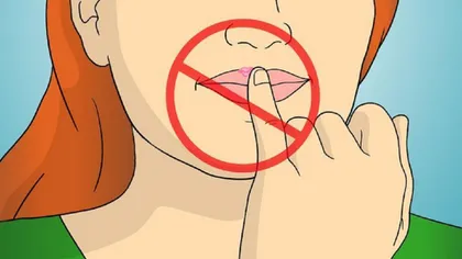 5 lucruri pe care trebuie să le ştii dacă ai herpes bucal