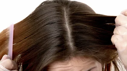 Ce BOLI pot ascunde mătreaţa şi albirea prematură a părului