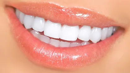 10 lucruri pe care nu le ştiai despre faţetele dentare