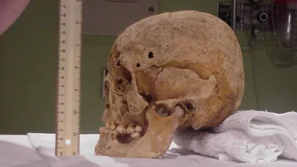 ULUITOR! Operaţie pe creier făcută în zona Munţilor Apuseni acum 4500 de ani