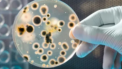 STUDIU: Numărul bacteriilor dintr-o bucătărie obişnuită poate fi de 100.000 de ori mai mare decât în baie