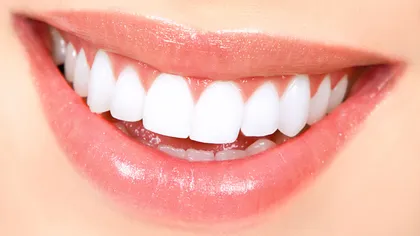 Cum se face corect albirea dentară