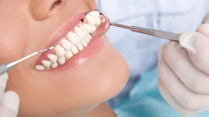 La ce afecţiuni te supui atunci când alegi un implant dentar ieftin?