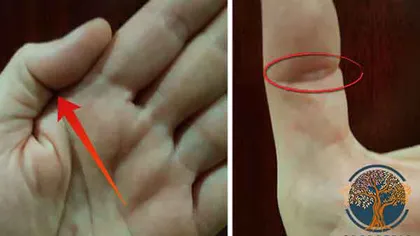 Persoanele cu acest contur la deget sunt speciale. Tu îl ai?